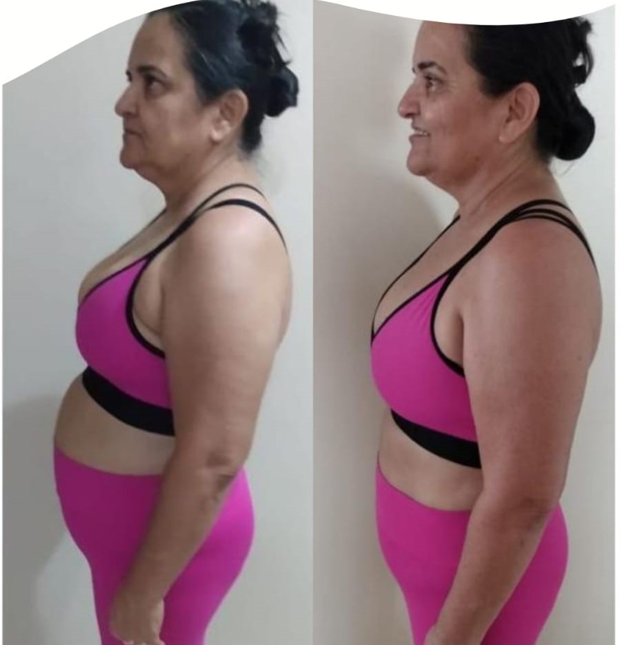 Hoje não tenho mais vergonha de sair ou tirar foto